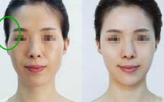 仅仅这个部位有凹陷，居然被众人指责克夫，实在不可理喻