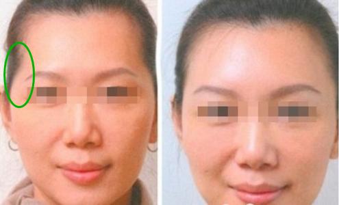仅仅这个部位有凹陷，居然被众人指责克夫，实在不可理喻-第3张图片-90博客网