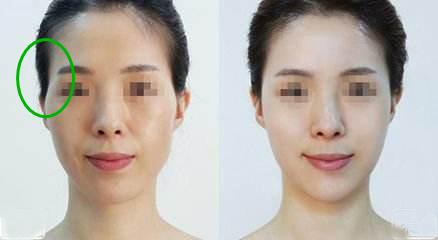 仅仅这个部位有凹陷，居然被众人指责克夫，实在不可理喻-第1张图片-90博客网