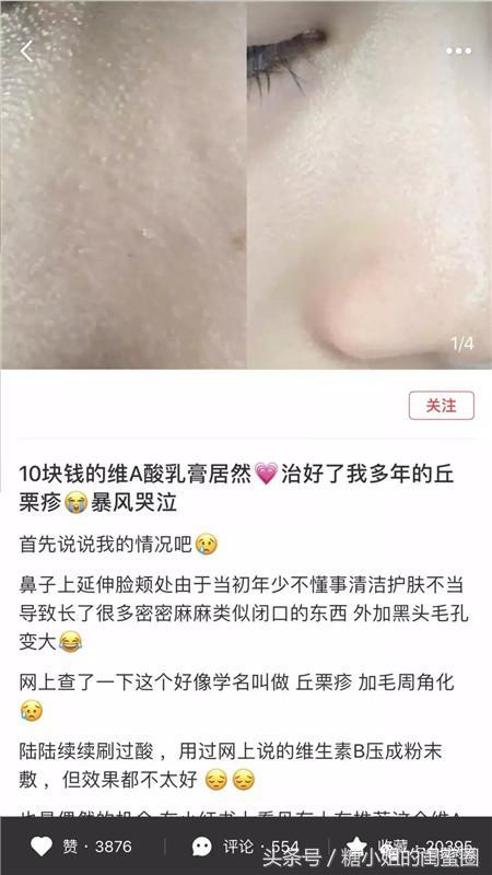 小红书的种草套路你看懂了多少?还当点赞收藏过万就靠谱?-第3张图片-90博客网 小红书的种草套路你看懂了多少?还当点赞收藏过万就靠谱?-第3张图片-90博客网