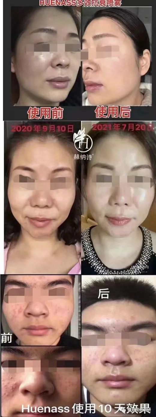 普通化妆品宣传特殊用途化妆品功效，赫纳诗涉嫌虚假宣传 ... ...-第21张图片-90博客网