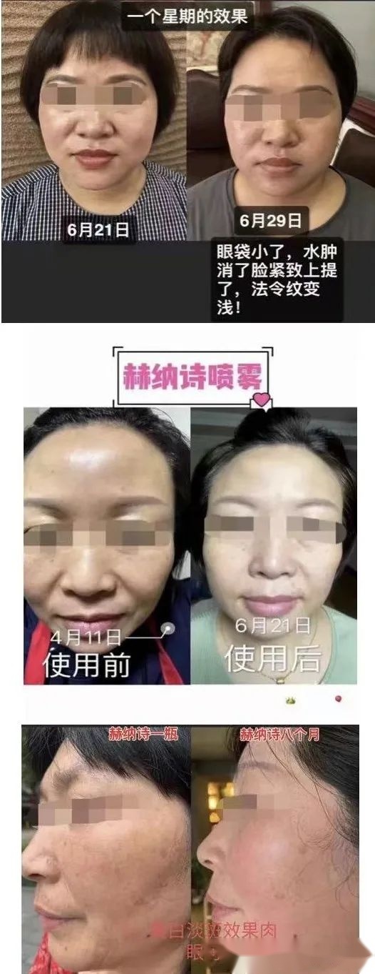 普通化妆品宣传特殊用途化妆品功效，赫纳诗涉嫌虚假宣传 ... ...-第22张图片-90博客网